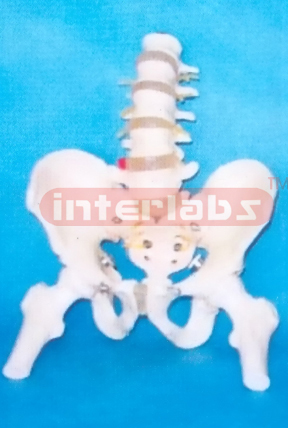 MALE PELVIS WITH 5 LUMBARS & FEMUR HEADS